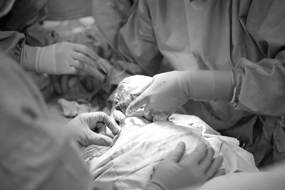 Ireland has fifth-highest rate in the OECD which has an average of 28 per 100 births. Photo: Getty