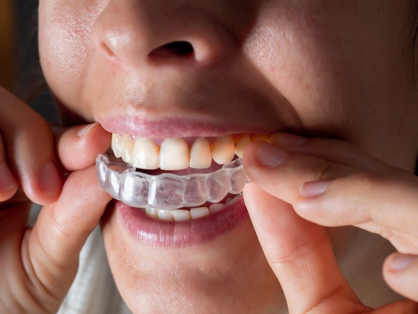 The group of dentists are part of the most successful Invisalign group globally – the AACA (American Academy of Clear Aligners). Photo: Getty