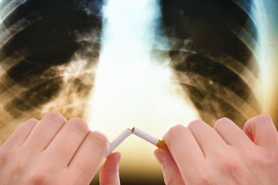 Lung cancer has overtaken breast cancer as the biggest cause of cancer death in women in Ireland