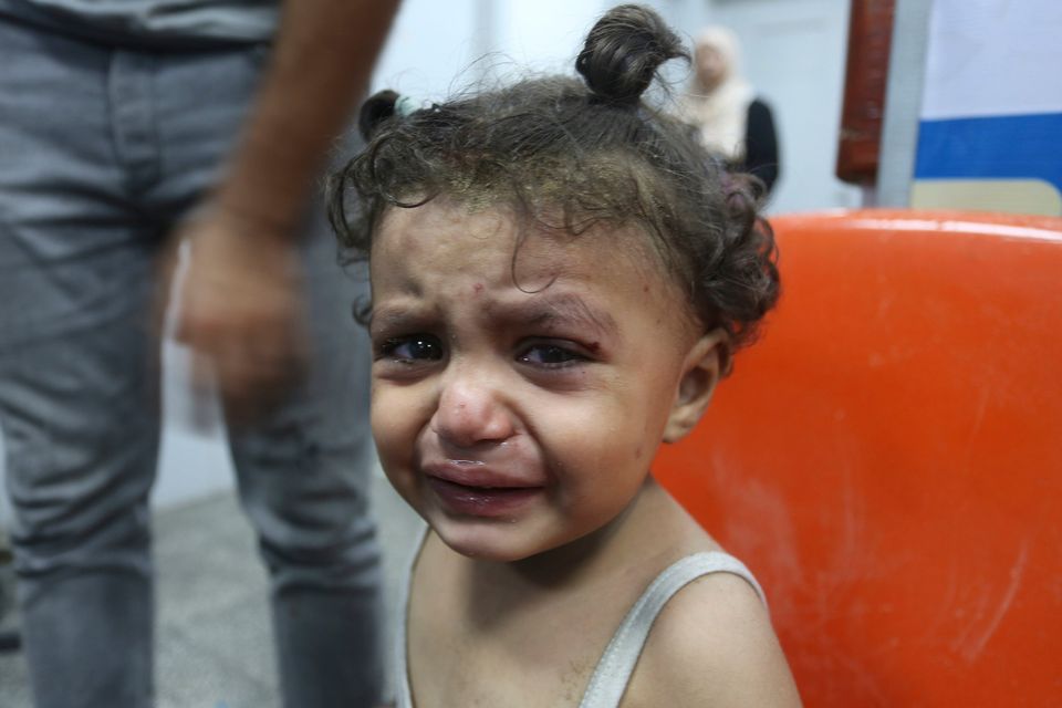 A Palestinian girl wounded in an Israeli strike on the Gaza Strip waits for treatment in a hospital in Rafah on Monday, Oct. 30, 2023. (AP Photo/Hatem Ali)