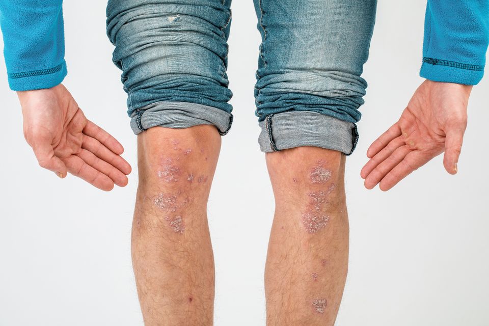 Ask the doctor: Should I be worried about the weird rash under my