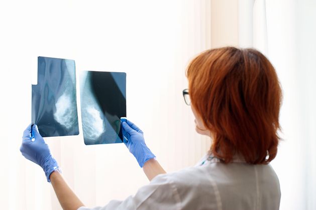 Over 11,600 patients with suspected breast cancer not assessed within clinics' target time last year