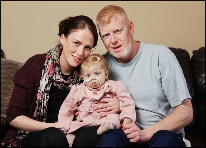 ‘There was no better motivation’ – father drops 10kg in six weeks to donate liver to baby girl