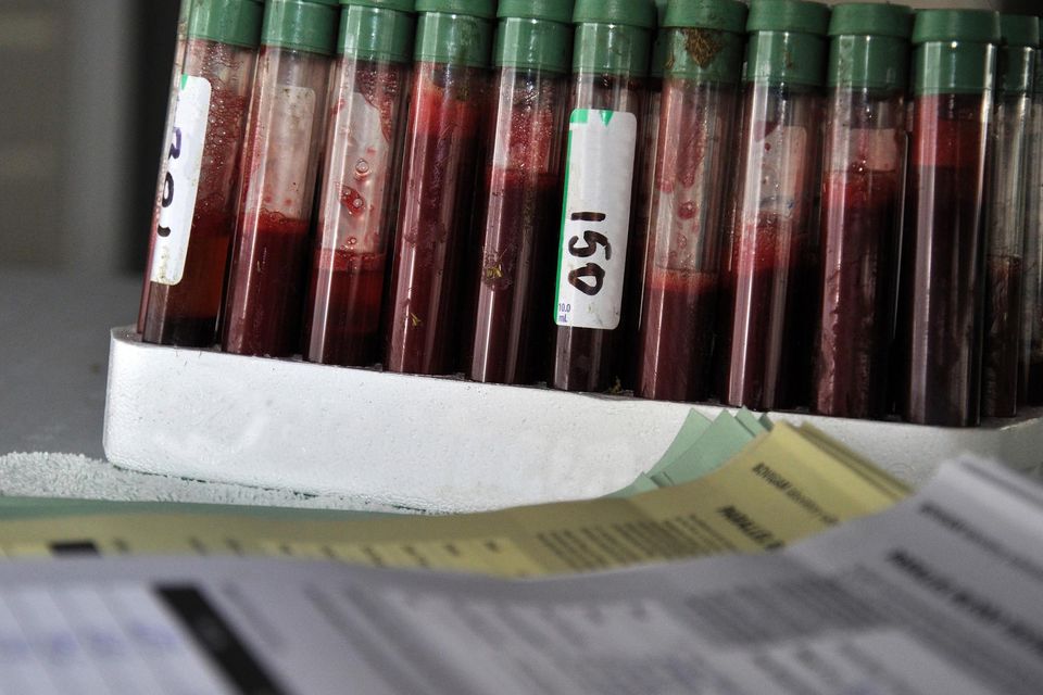 Traumatic process: A rack of blood samples for bovine TB. Photo: Getty