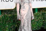 thumbnail: Actress Nicole Kidman attends the 74th Annual Golden Globe Awards at The Beverly Hilton Hotel on January 8, 2017 in Beverly Hills, California.  (Photo by Frazer Harrison/Getty Images)