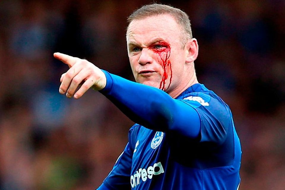 Wayne Rooney points an accusing finger after suffering an eye cut that makes him doubtful for Thursday’s Europa League match against Apollon Limassol. Photo: Barrington Coombs/PA Wire