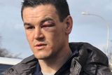 thumbnail: Johnny Sexton