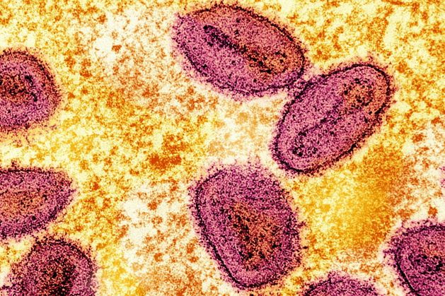 US health officials report first case of new form of mpox in man who visited Africa