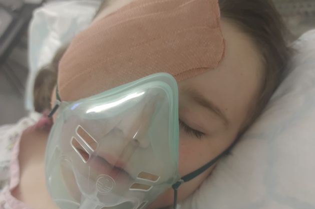 ‘We’re devastated’ – young Dublin girl loses eye after suspected vape battery explodes from bonfire in housing estate