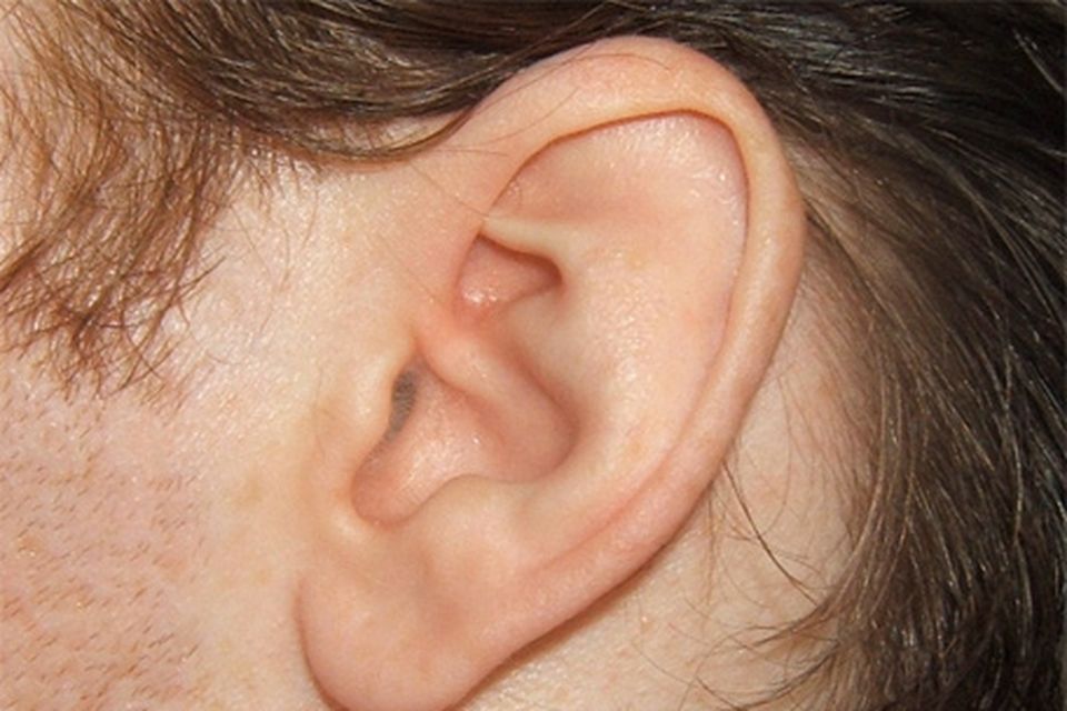 Как выглядит клещ в ухе Tiny device that heralds the end of unsightly hearing aids Irish Independent