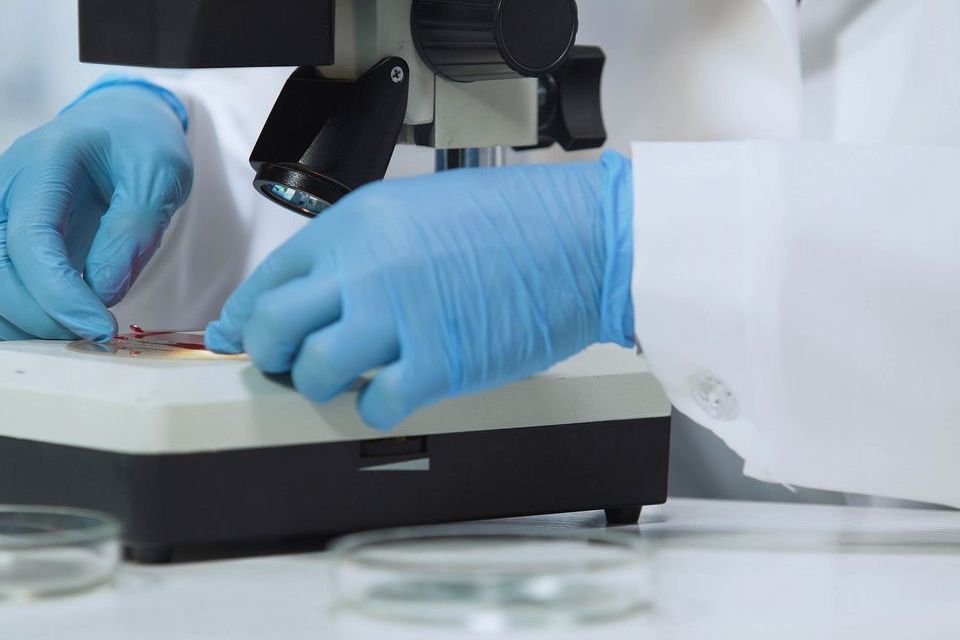 People living in Ireland aged 17 and older can order STI test kits online and carry out the tests at home