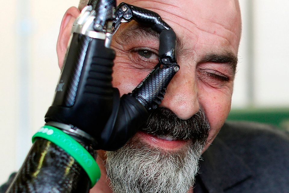 bionic arm prosthetics prop