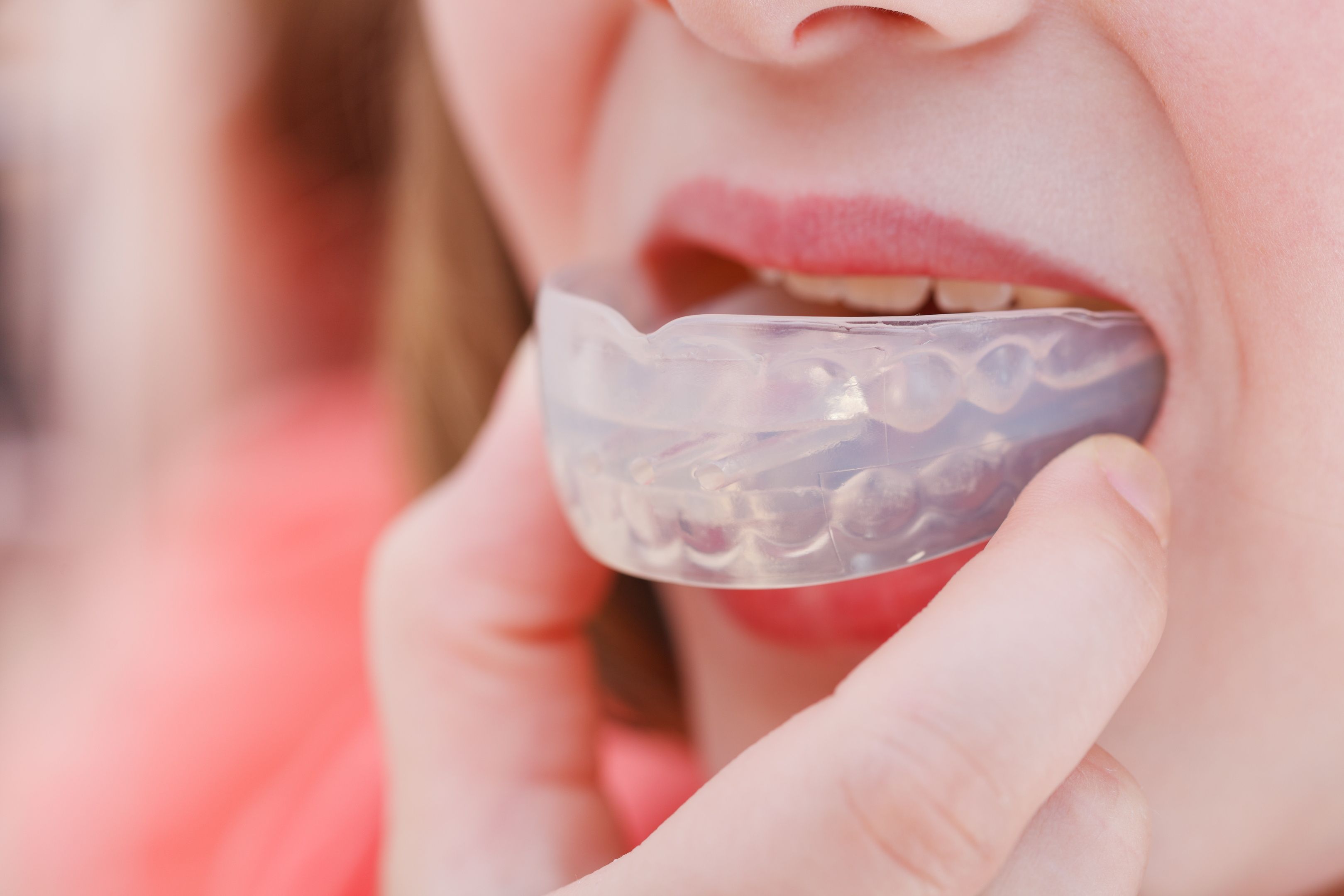 Is Patrick Mahomes' Mouthpiece Invisalign