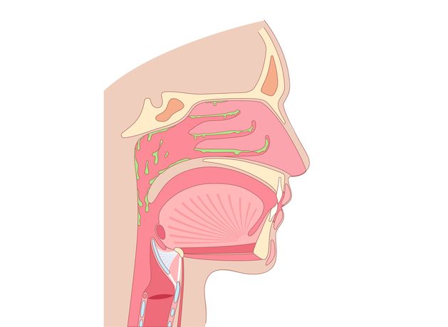Stay Well: My husband's constant cough is down to post-nasal drip. What is it and how does he get rid of it?