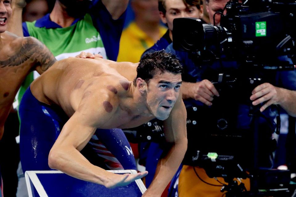Michael Phelps had the red marks on his right shoulder last night