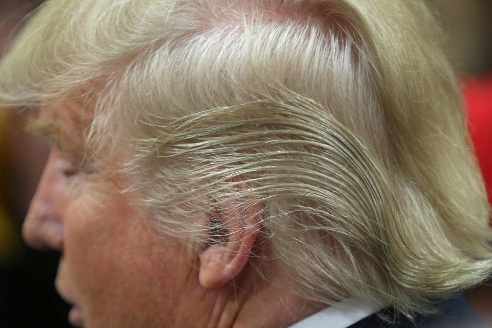 Hair loss drug used by Donald Trump can cause sexual dysfunction