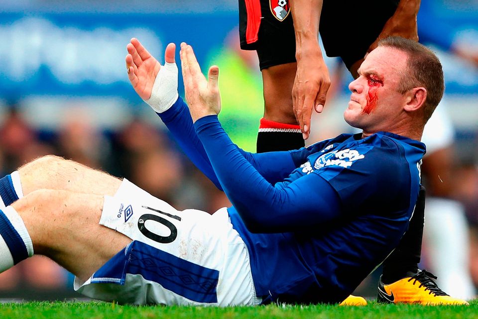 LIVERPOOL, ENGLAND - SEPTEMBER 23: Wayne Rooney of Everton goes down injured with a face injury during the Premier League match between Everton and AFC Bournemouth at Goodison Park on September 23, 2017 in Liverpool, England.  (Photo by Matthew Lewis/Getty Images)