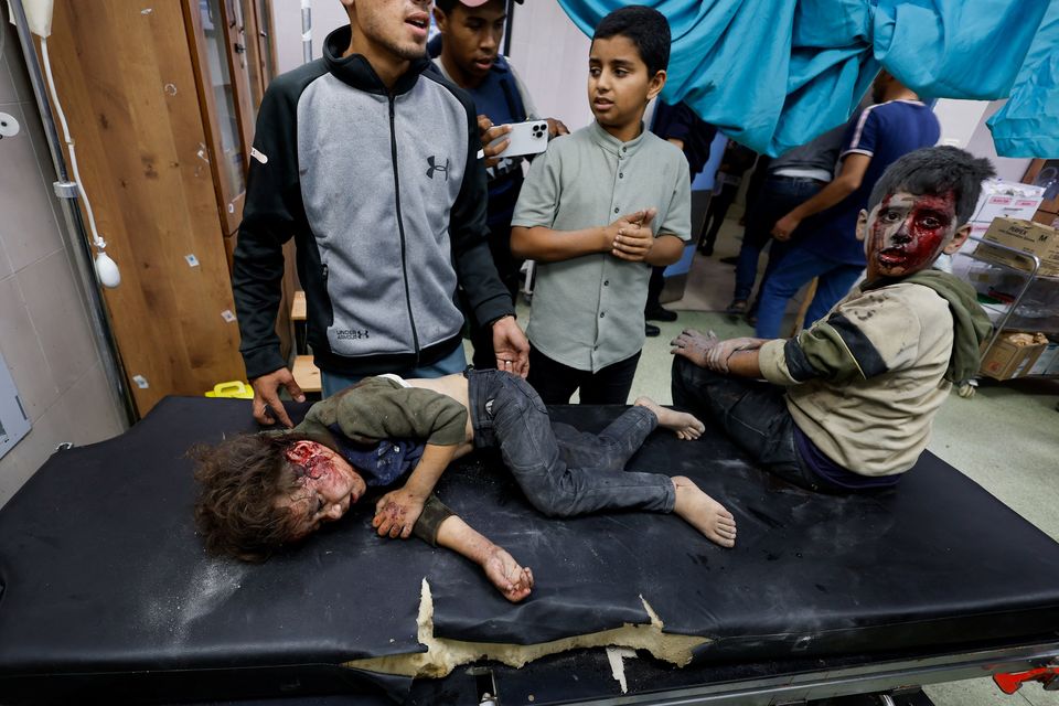 Palestinian children wounded in an Israeli strike at Nasser Hospital in Khan Yunis in the southern Gaza Strip. Photo: Reuters