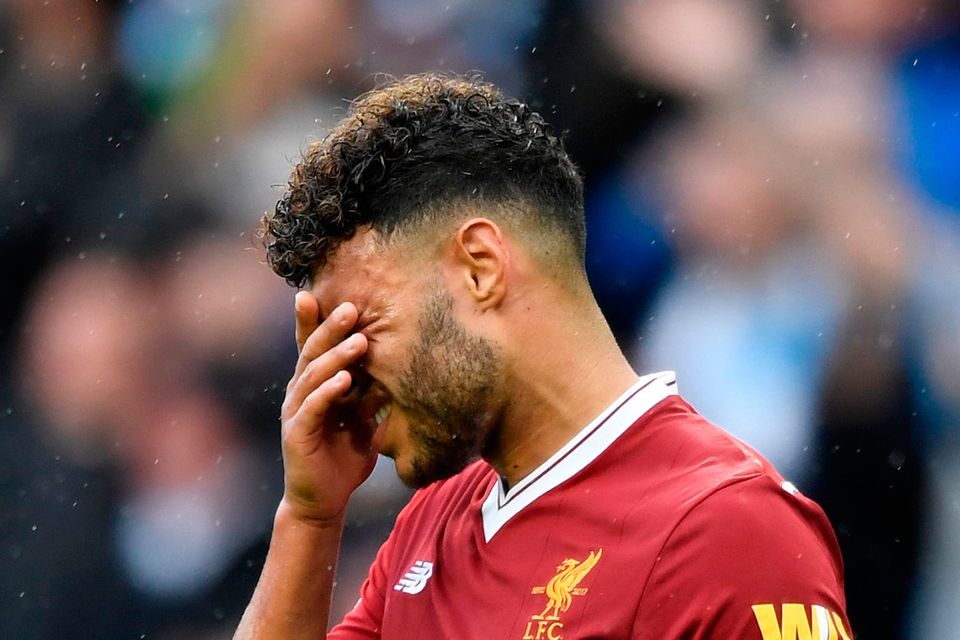 MANCHESTER, ENGLAND - SEPTEMBER 09: Alex Oxlade-Chamberlain of Liverpool reacts after the Premier League match between Manchester City and Liverpool at Etihad Stadium on September 9, 2017 in Manchester, England.  (Photo by Stu Forster/Getty Images)