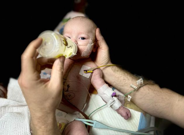 Extraordinary photo shows surgeon sharing his own blood with Ukrainian baby born with ‘Chernobyl Heart’ in a bomb shelter