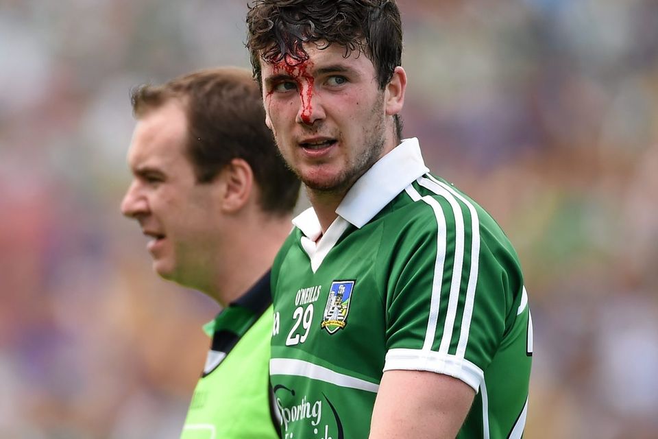 Declan Hannon, here showing the scars of battle during the summer, believes Limerick are not far off hurling's elite