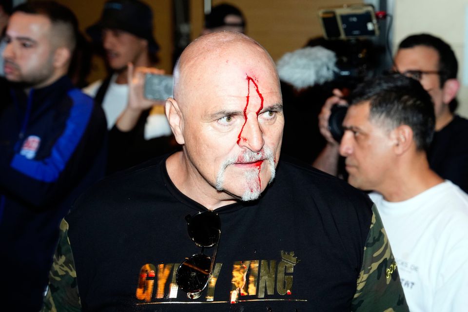 John Fury, father of boxer Tyson, with blood on his face during a media day in Riyadh. Photo: Nick Potts/PA Wire