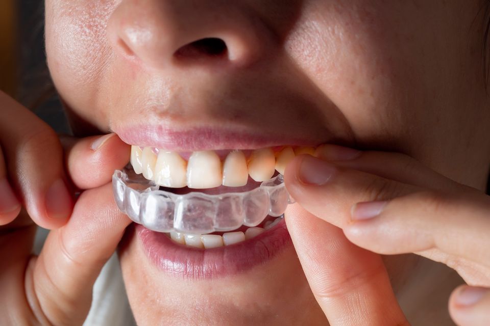 The group of dentists are part of the most successful Invisalign group globally – the AACA (American Academy of Clear Aligners). Photo: Getty