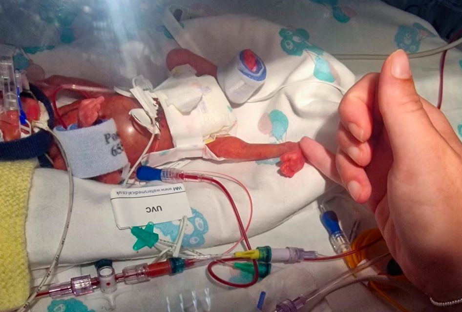 Miracle Baby appeals for medical support after successful surgery