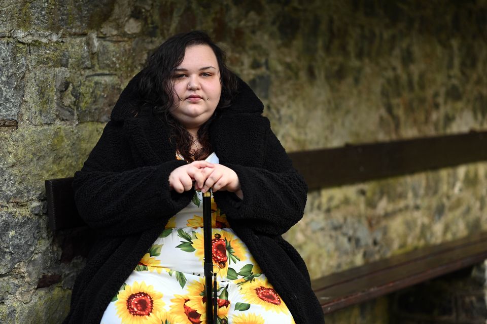 Abigail Stone (21) has suffered from fibromyalgia and migraines since her early teens. Photo: Ray Ryan