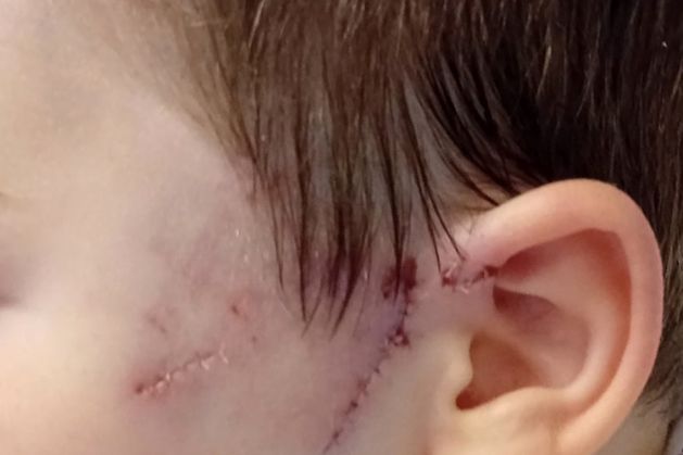 ‘The dog tore the face off him’ – father speaks of horror at attack on son (8) in Limerick park