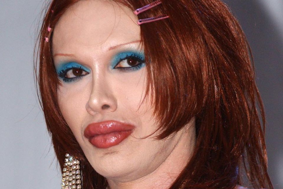 Pete Burns died on Sunday after suffering a cardiac arrest