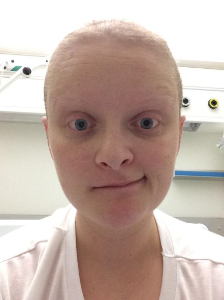 Louse McSharry tweets a photo of herself during her battle with Hodgkin's Lymphoma.