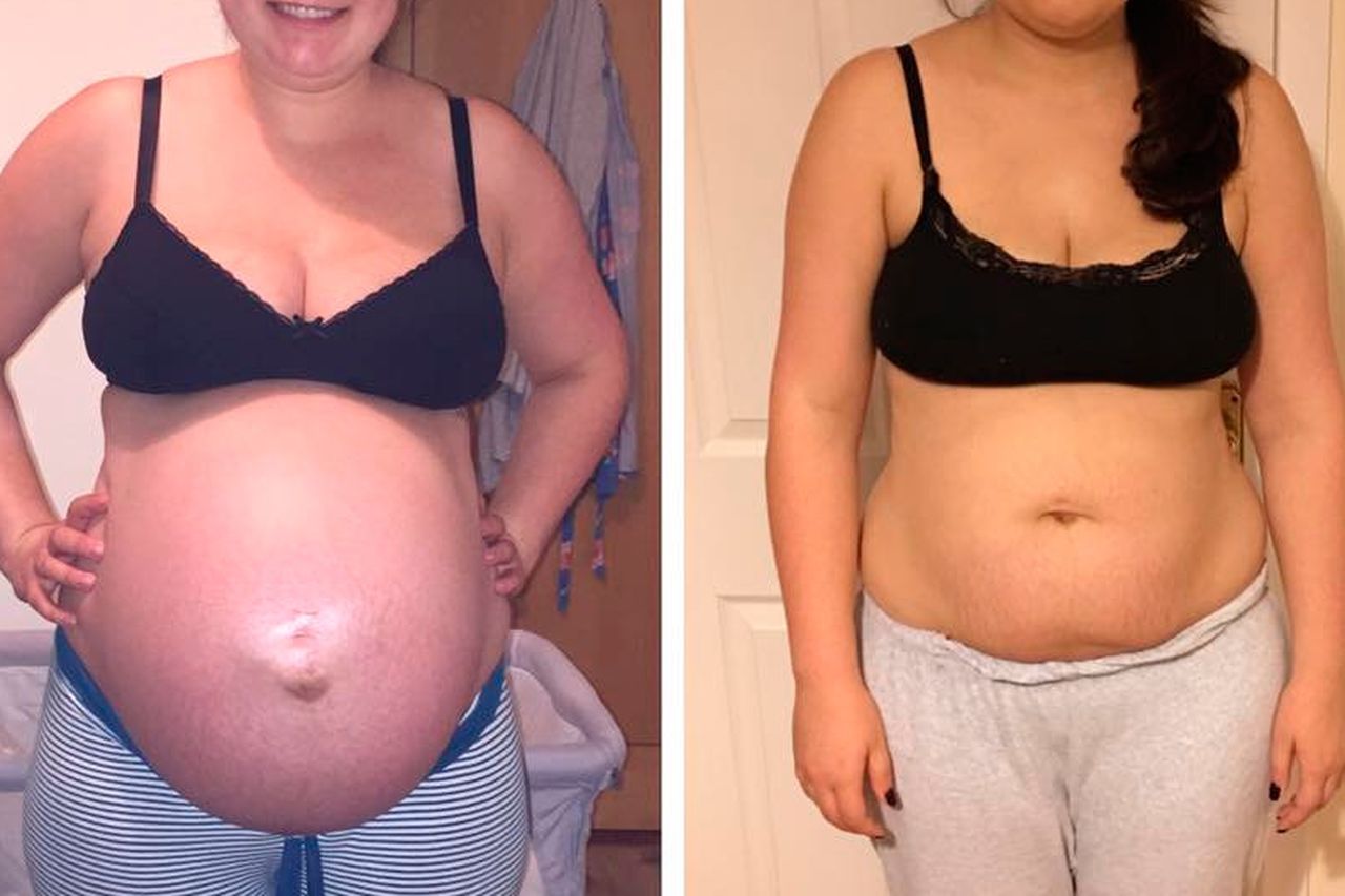 Instagrammer Mia Redworth shares post-baby stomach photo