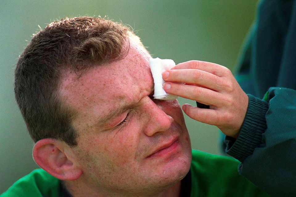 David Corkery: ‘I’m not going to lie, I did take injections just to go training, let alone play.’ Picture by Aoife Rice/Sportsfile