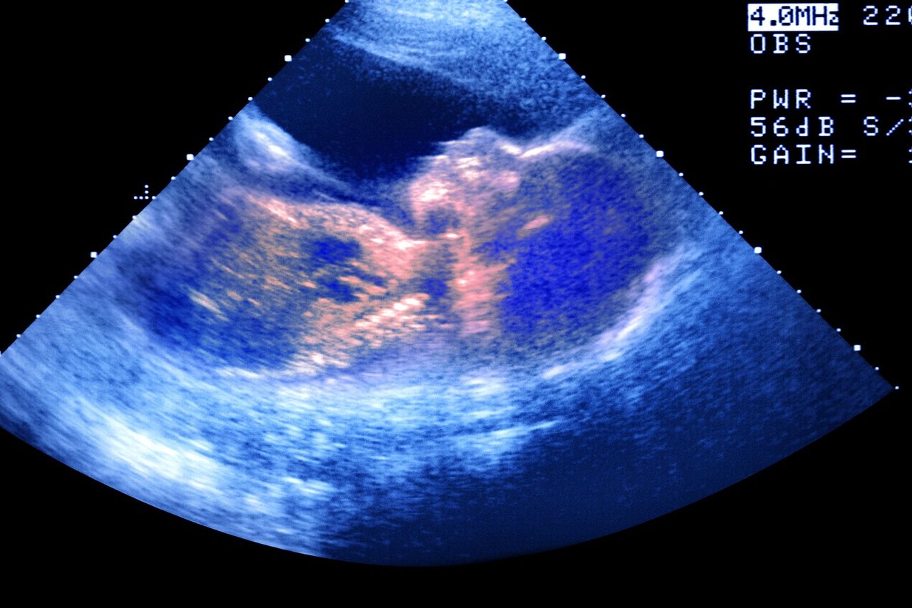 Irish couple who battled infertility expecting child following