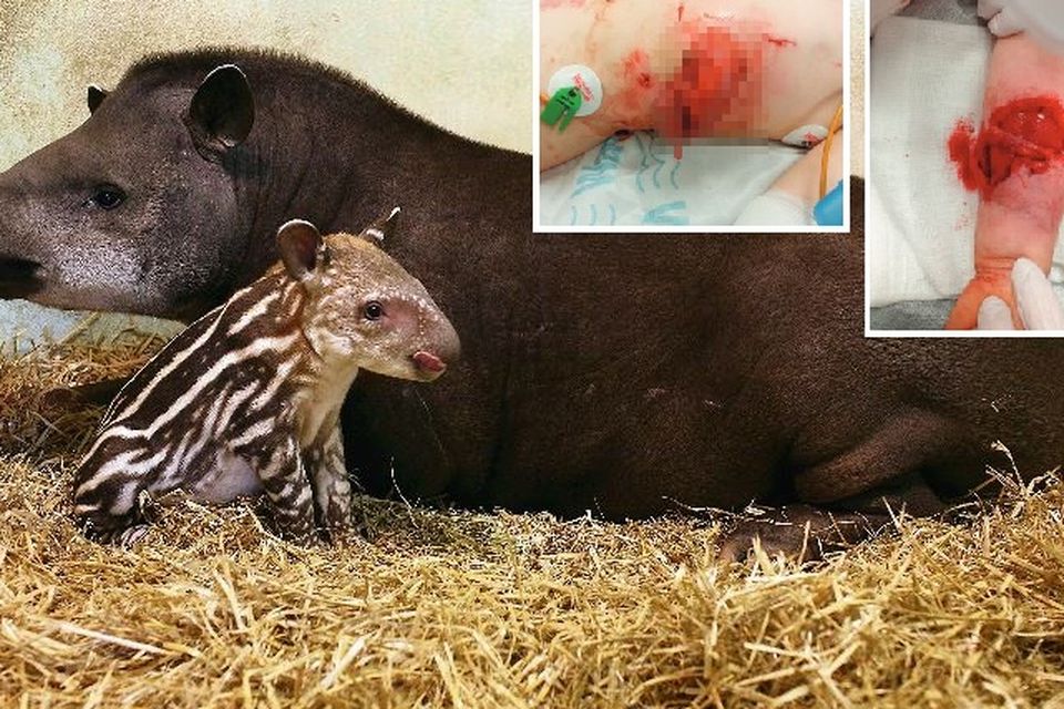 The two-year-old girl sustained multiple injuries in the attack by the plant-eating animal, including laceration of the forearm and multiple perforating wounds to her stomach, the Irish Medical Journal reports. Pictured: Rio the tapir and (inset) the girl's injuries