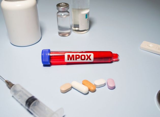 High alert issued after first case of dangerous mpox strain confirmed in UK