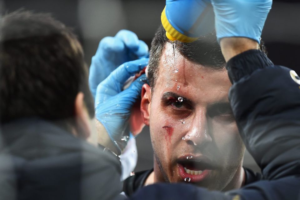 Newcastle United's Steven Taylor receives treatment after colliding with the post during his side's Premier League clash with Sunderland at St James' Park. Photo: Laurence Griffiths/Getty Images