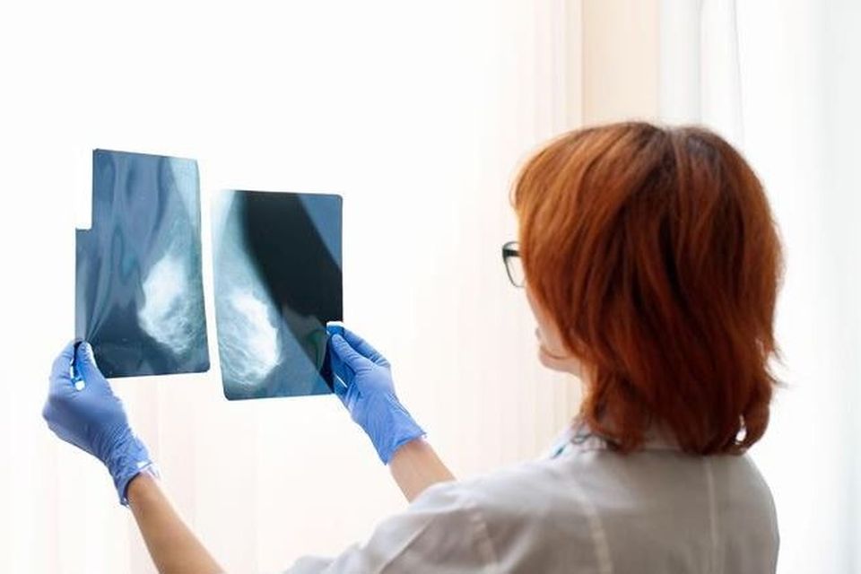Cancer diagnoses were delayed due to Covid, the report revealed. Stock image