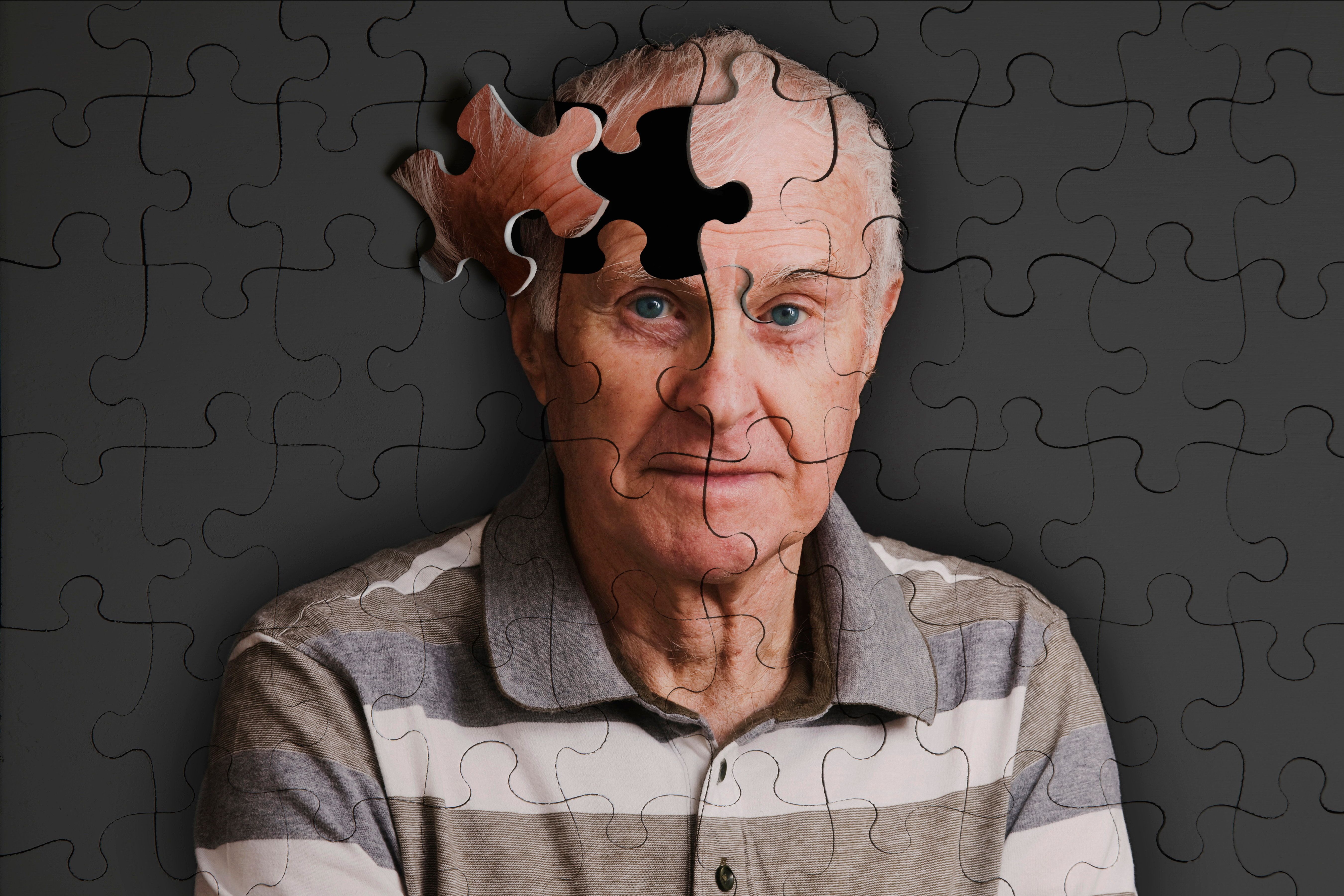 Unveiling the Link: Early Signs of Alzheimer’s May Include Losing Your Sense of Direction