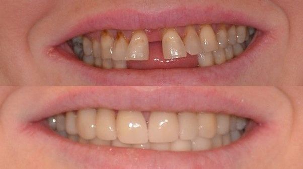 Dental treatment in Hungary: Helvetic Clinics expands its facilities in  response to growing number of Irish patients | Irish Independent