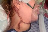 thumbnail: Tazmyn after having her lymph nodes removed at 23 weeks pregnant.