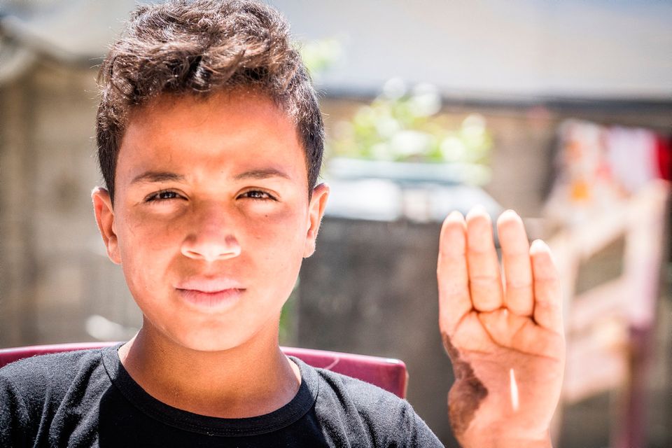 Horror: Pictured in Palestine was 14-year-old Amed Alhalw who told John: "I lost my thumb. I have developed a bad stammer. Every noise makes me jump." Photo: John McColgan