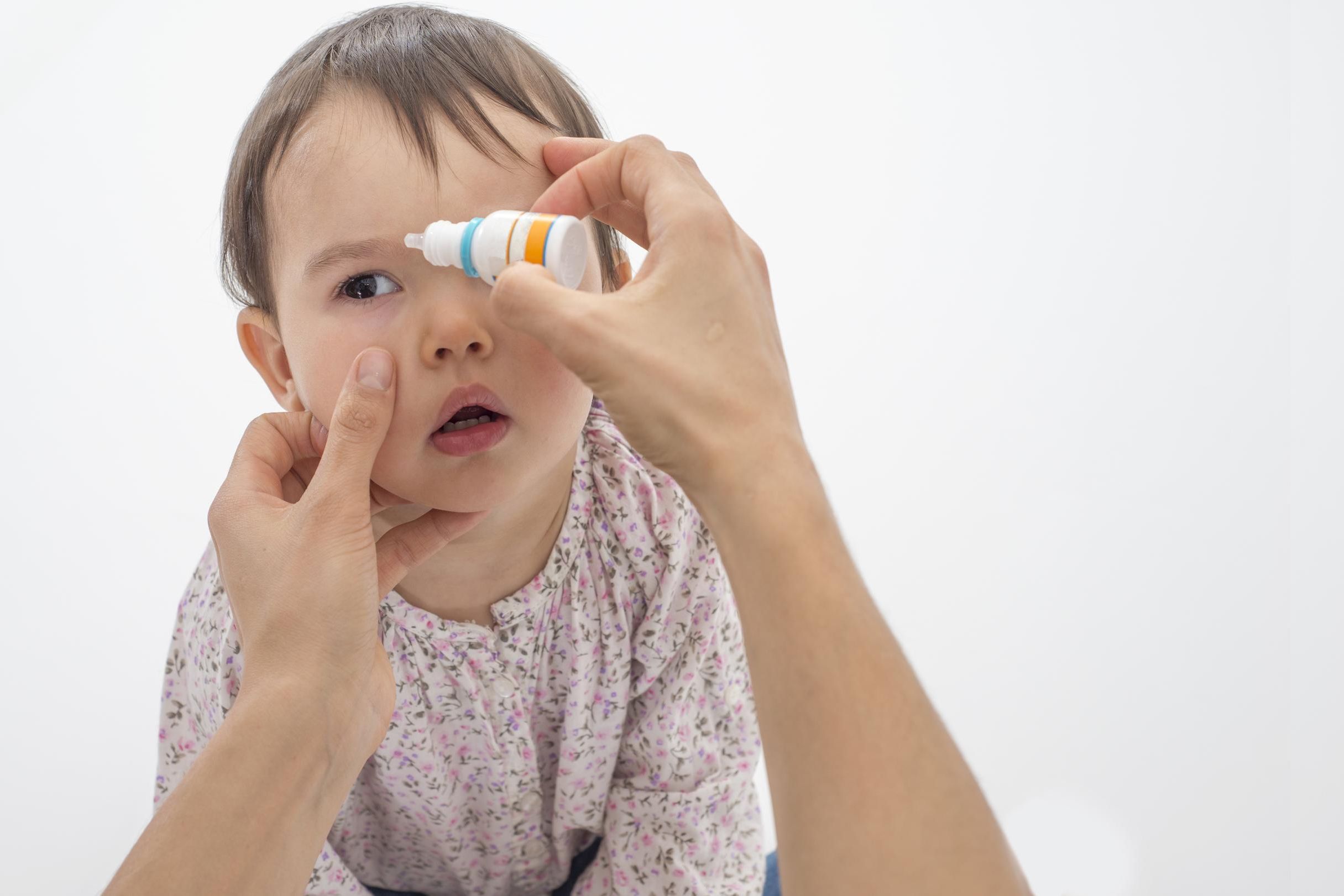 Конъюнктивит ребенка 6 лет. Конъюнктивит у детей закапывание глаз. Аллергический риноконъюнктивит у детей. Аллергического риноконъюнктивита.