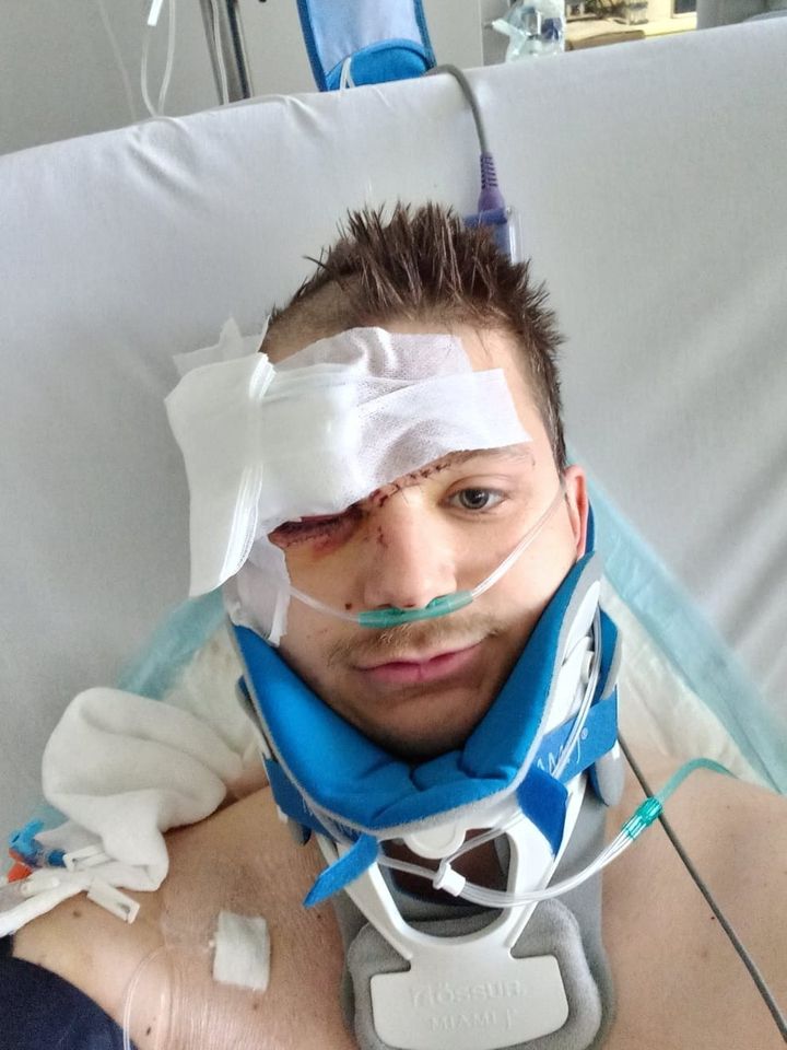 Man’s eye rebuilt after eight painstaking operations following car crash