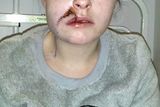 thumbnail: Nicole Dwyer from Wexford town. Nicole was attacked with a hatchet on the evening of Monday January 12, 2014