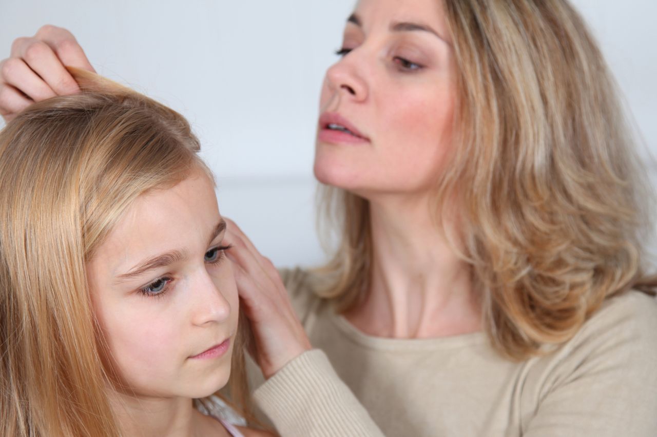 How To Identify Head Lice And The Best Way To Get Rid Of Them Irish Independent 7902