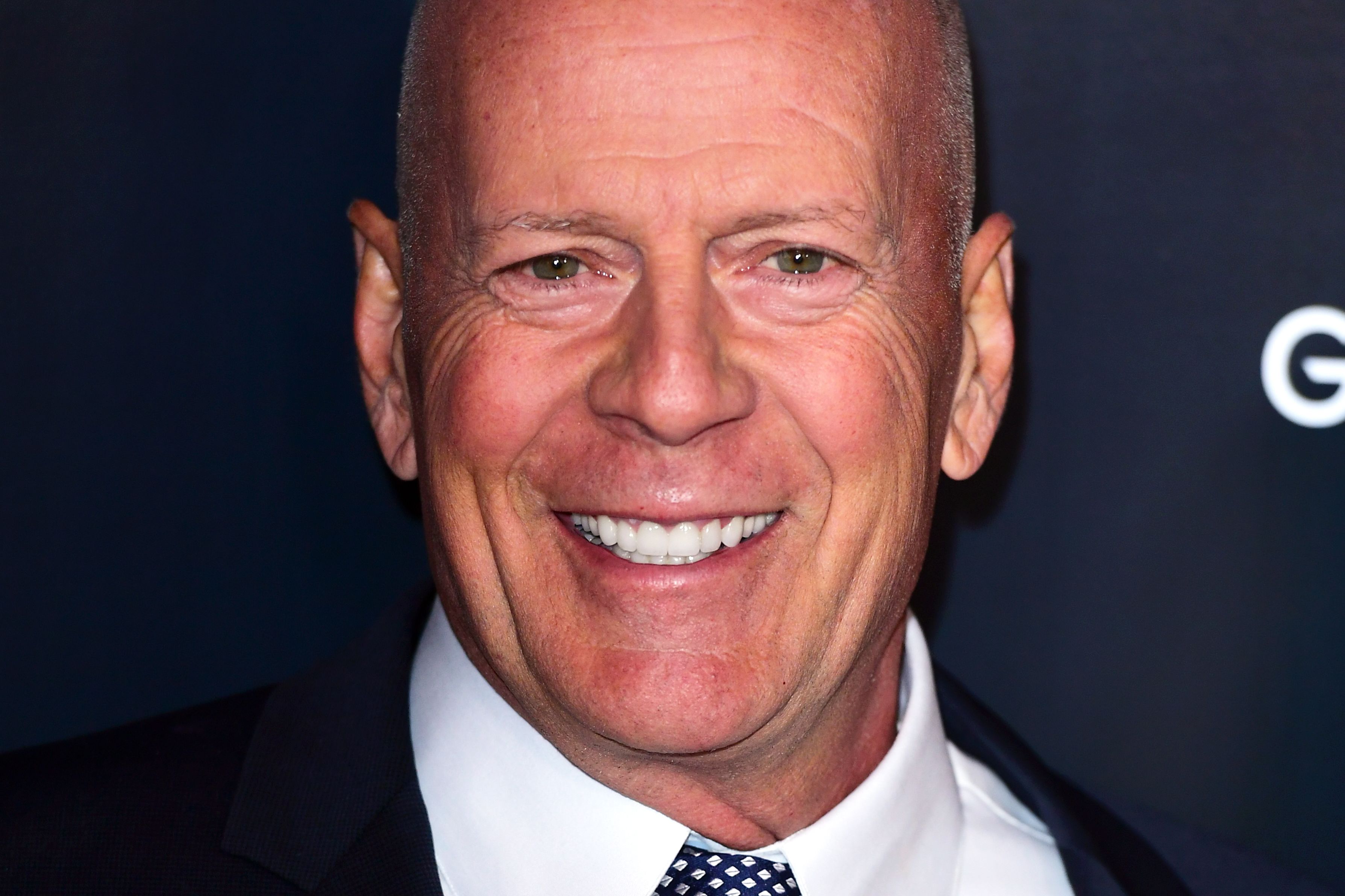 Discovering Bruce Willis’s Self-Awareness: Insights from His Wife about his Condition