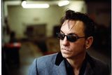 thumbnail: A 17-year-old Richard Hawley refused the operation to get rid of the scarring on his upper lip, saying the scar was part of him